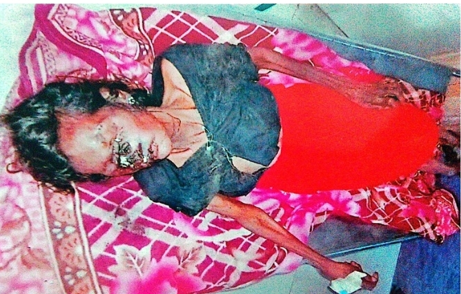 অজ্ঞাত মৃত মহিলার পরিচয় শনাক্তে সহায়তা চায়।